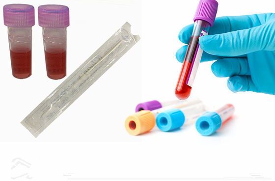 Tamponi orali affollati del DNA per la campionatura del tampone sterile di trasporto della fibra di nylon con la metropolitana